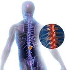 Spine Injuries